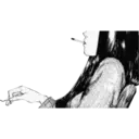 ملصق